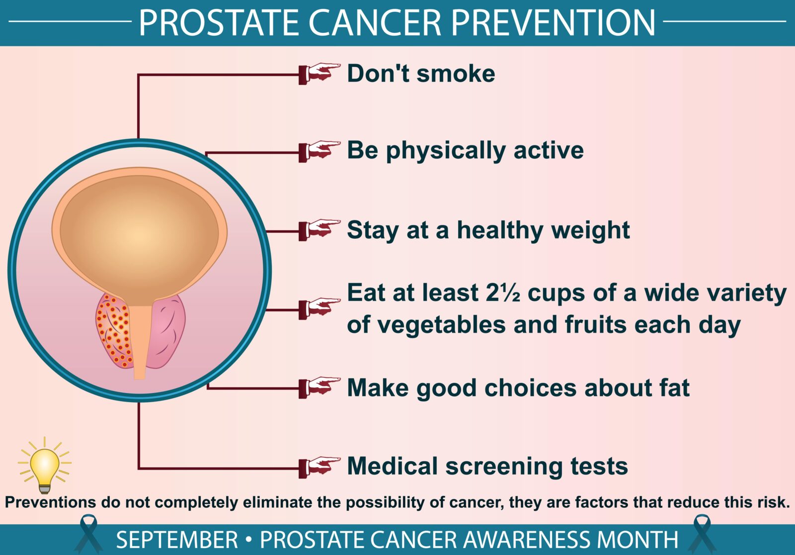 prostate cancer prevention