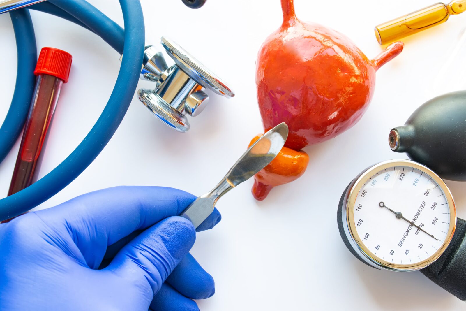 prostate surgery
