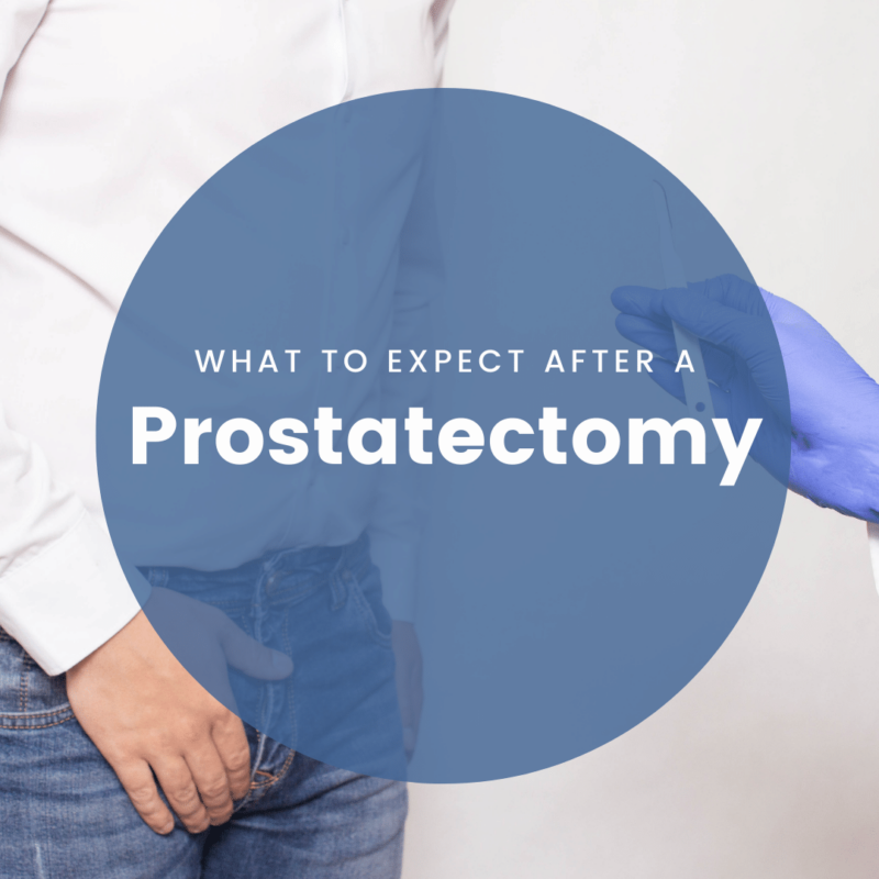 What to Expect After a prostatectomy